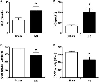 Antioxidative and Antiapoptotic Effects of Delta-Opioid Peptide [D-Ala2, D-Leu5] Enkephalin on Spinal Cord Ischemia-Reperfusion Injury in Rabbits